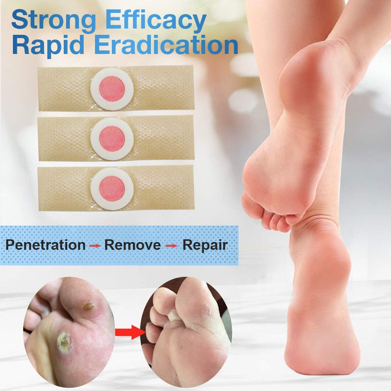 [Australia] - Wart Remover, Corn Remover Pads, Foot Corn Removal Plaster with Hole, Professional Removes Common and Plantar Warts, Callus, Stops Wart Regrowth 24Pcs (24 pcs) 