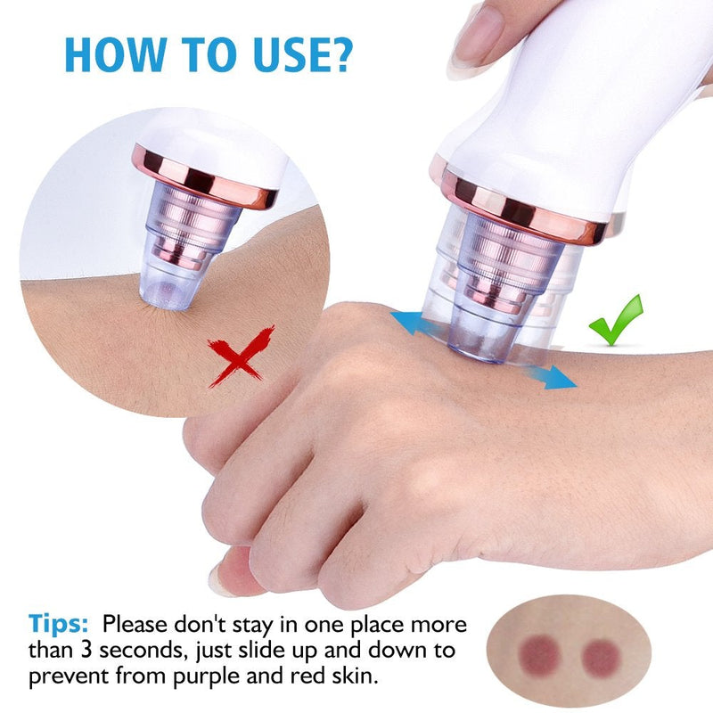 [Australia] - Aibeau Blackhead Remover Electric Blackhead Vacuum Suction Rechargeable Whitehead Remover Tool Kite Cleanser with 4 Replaceable Heads, Hot Pack Function and 3 Modes 