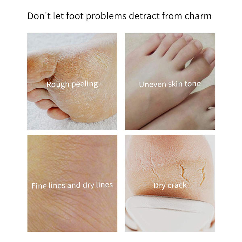 [Australia] - YOUPINWEI Moisturizing Foot Mask Treatment for Cracked Heels and Dry Feet Deeply Repair, Care for Long-lasting Hydrating & Nourishing Socks for Smoother and Softer Feet (5Pairs/Box) 