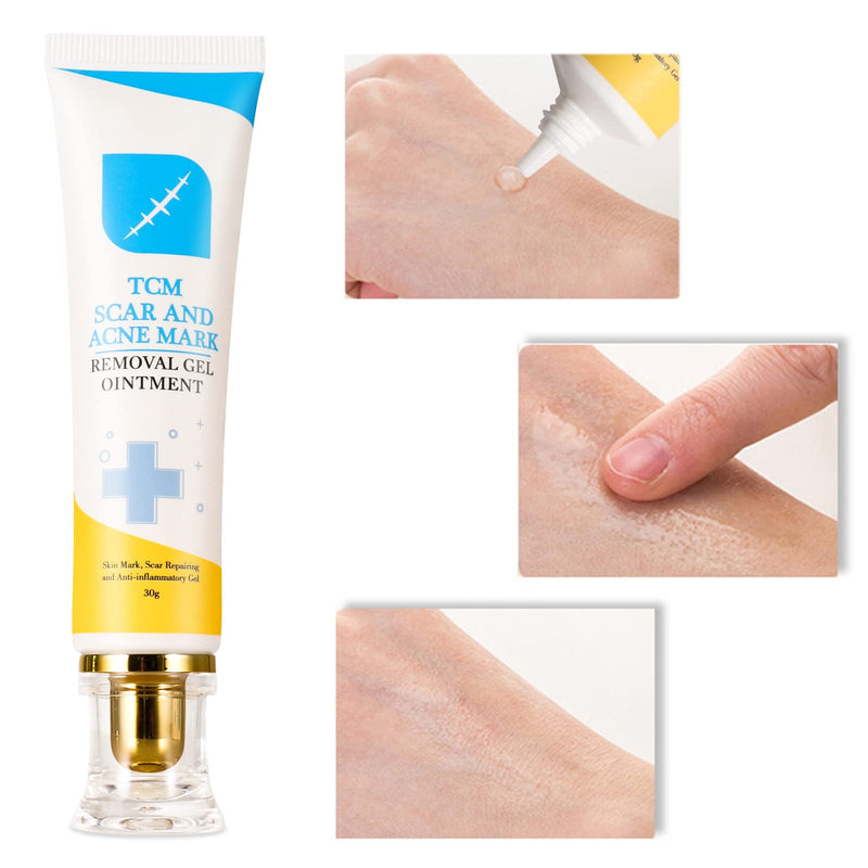 [Australia] - Scar and Acne Marks Removal Ointment Gel, Scar Removal Cream, Scar Gel for Scars Burns Cuts, Stretch Marks, Acne Spots, Old & New Scars, 30g 