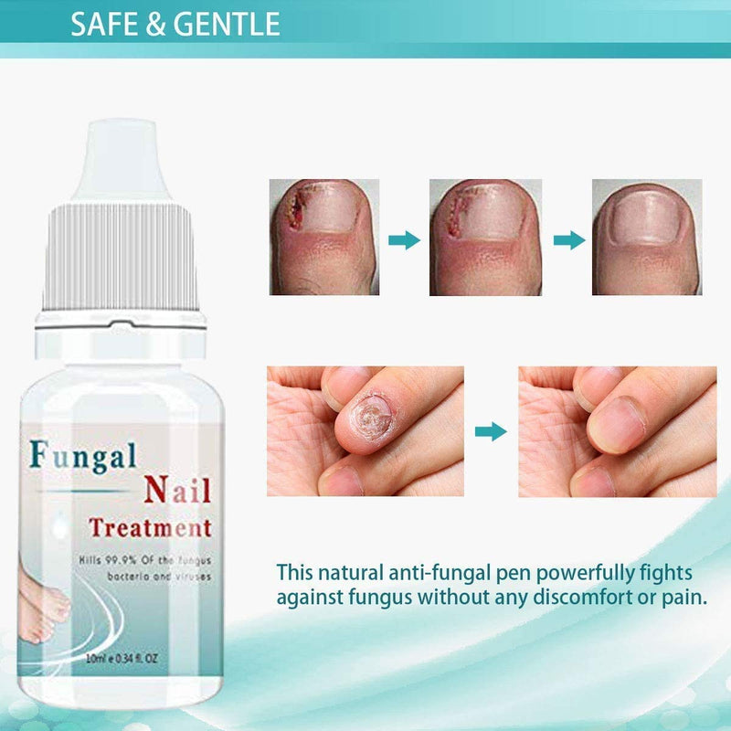 [Australia] - Fungal nail treatment, Nail Fungus Treatment, Anti fungal Nail Solution— Kills Fungus on Toenails & Fingernails(2PCS) 