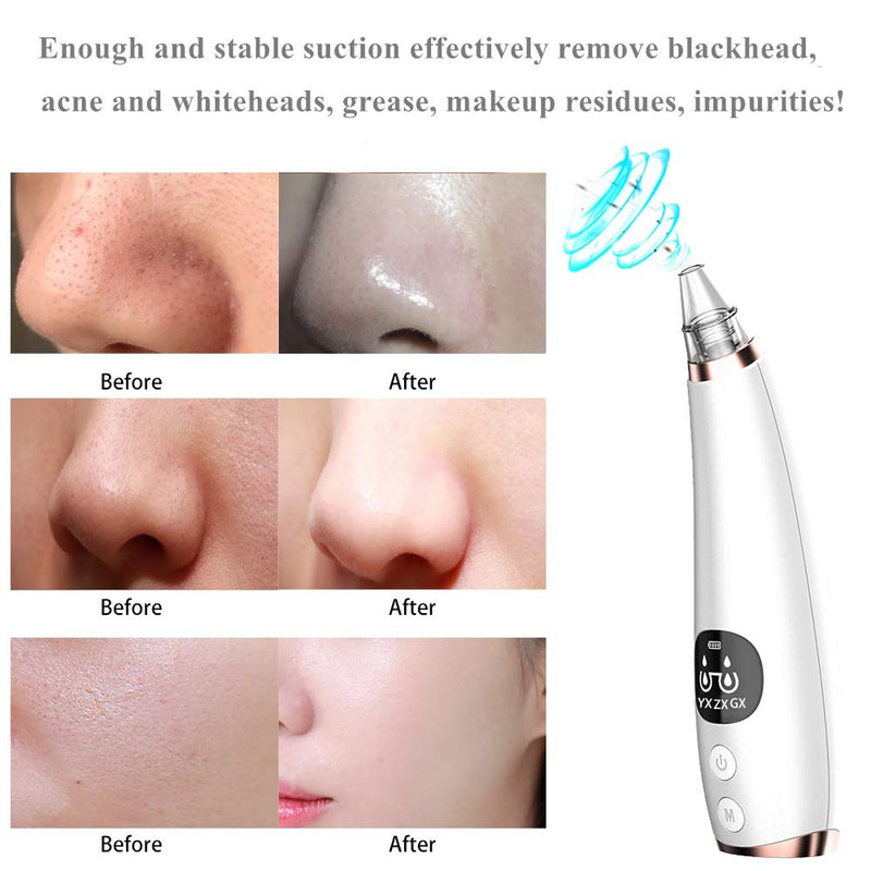 [Australia] - Blackhead Remover Extractor Tool, Vikano 7pcs Electric Acne Facial Pore Cleanser Suction Tool with LED Display, Extractor Acne Removal Kit for Blemish, Whitehead Popping, Zit Removing for All Skin Silver 