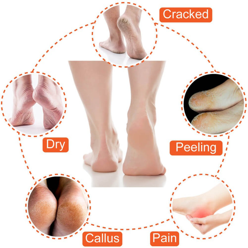 [Australia] - Selizo 5 Pairs Moisturizing Gel Heel Socks Open Toe Socks for Dry Hard Cracked Heels, 5 Colors 