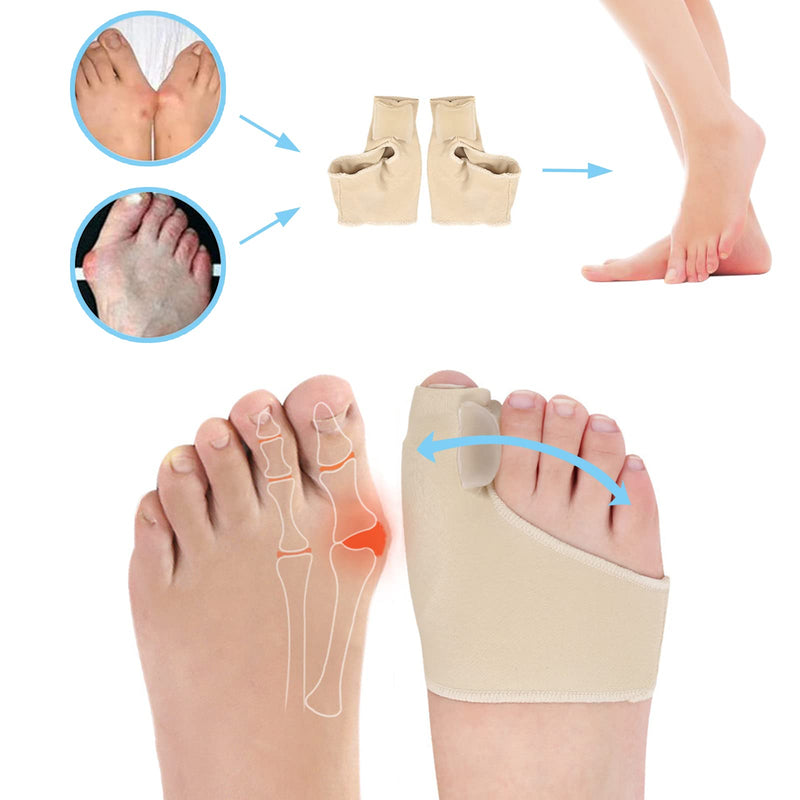[Australia] - Bunion Corrector Sleeve with Gel Pad,Big Toe Straightener,Bunion Splint Support Protectors Sleeve,Gel Bunion Corrector for Foot Pain Relief, Calluses, Corns(1 Pair) 