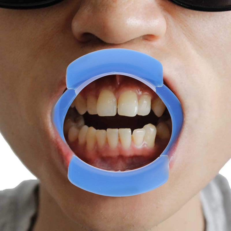 [Australia] - EXCEART 2pcs Lip Opener Dental Cheek Retractor Mouth Retractors Mouth Opener for Mouthguard Mouth Bite Block 
