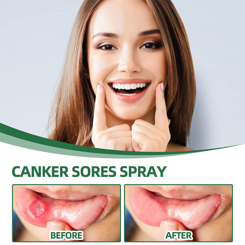 [Australia] - Cleanpure Antiviral Mouth Spray,Mouth Ulcer Treatment,Protect Teeth & Gums,Reduce Bad Breath,Dry Mouth Relief,Treat Mouth Ulcer,Natural Mouthwash Alcohol Free,20ml 20 ml 