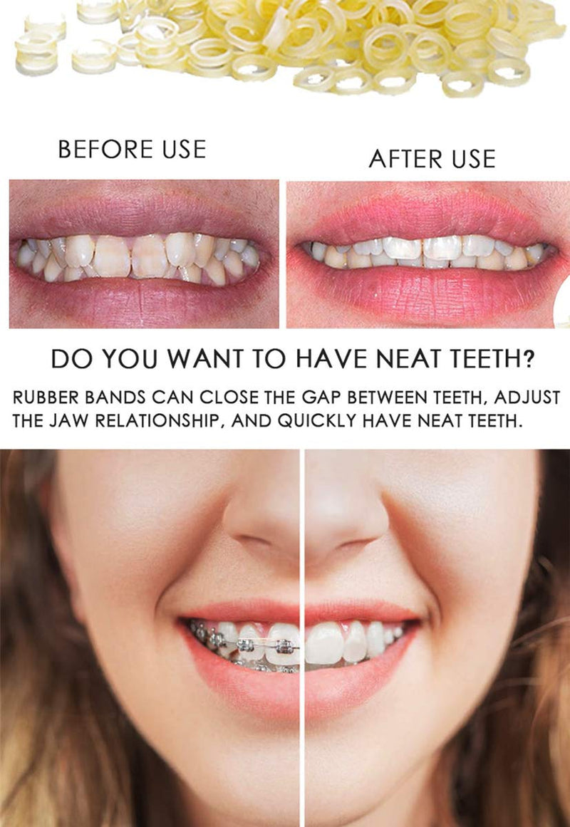 [Australia] - RZJZGZ 5 Pack (500 Pcs) Dental Orthodontic Elastics Latex Rubber Bands for Braces Great for Dentist, Dreadlocks, Braids, Top Knots (5/16 Inch) 5/16 Inch 