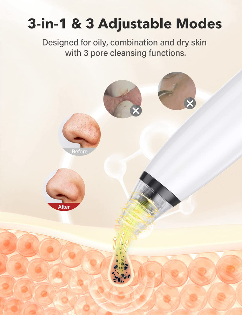 [Australia] - BEBIRDPRO Ear Wax Removal Tool Safely Cleaning Ear Canal at Home,Ear Cleaner with HD Camera and 6 LED Lights, Ear Camera and Wax Remover for iOS, Android Smart Phones M9, Red 