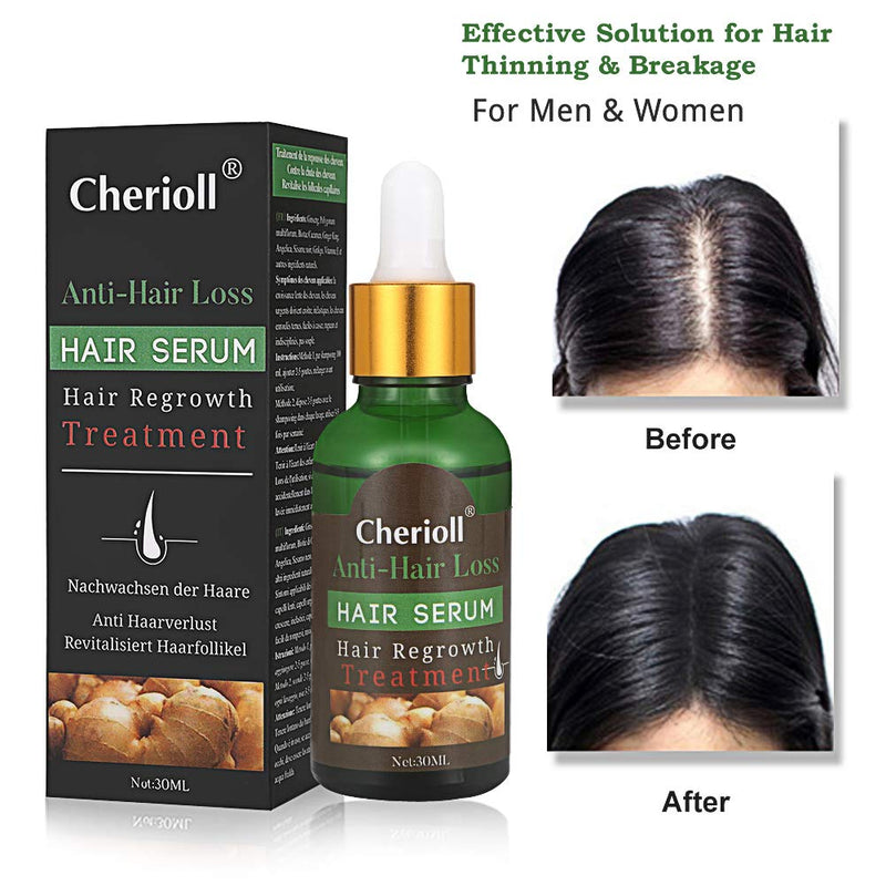 [Australia] - Hair Growth Serum, Hair Loss and Hair Thinning Treatment, Stops Hair Loss, Thinning, Balding, Repairs Hair Follicles, Promotes Thicker, Stronger Hair and New Hair Growth 