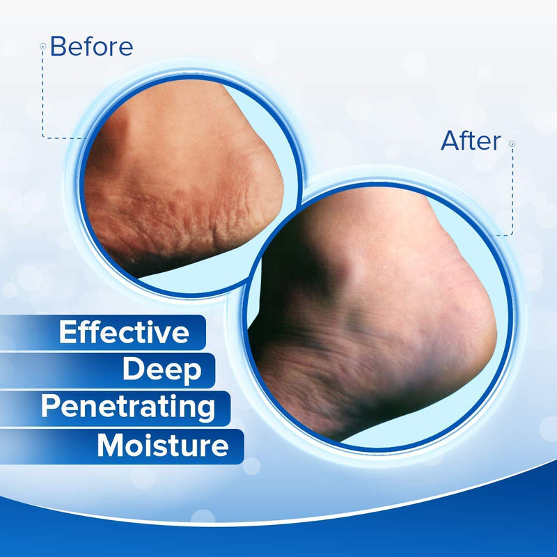 [Australia] - Dermal Therapy Heel Care Cream - Moisturizing Treatment that Repairs and Heals Dry, Rough, Cracked Heels and Feet | 25% Urea and 6% Alpha Hydroxy Acids (8 Ounce) | Packaging May Vary 8 Ounce (Pack of 1) 