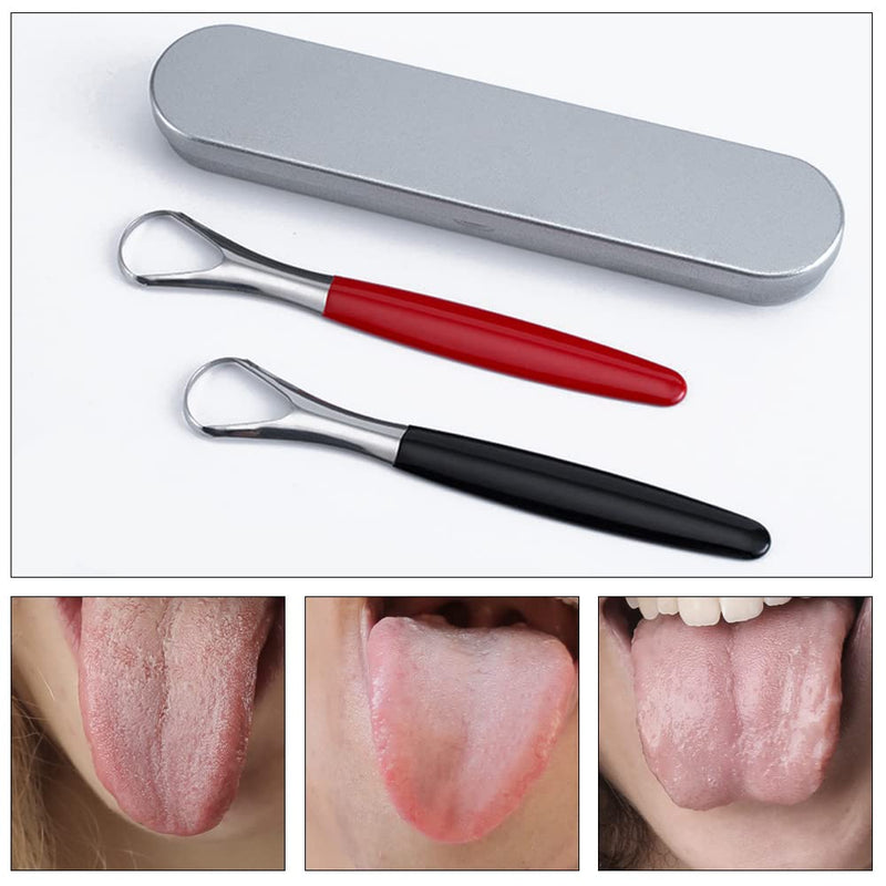 [Australia] - 2 Pcs Stainless Steel Tongue Brush Set Tongue Scraper Cleaner Professional Tongue Scraper with Case for Bad Breath Oral Care Fresh Breath 