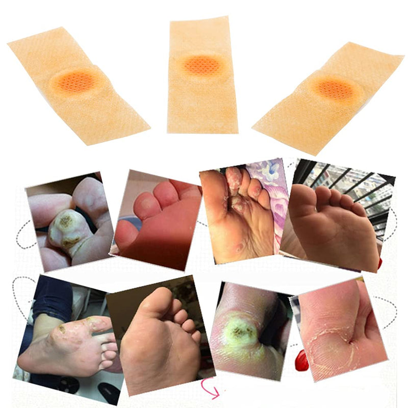 [Australia] - Wart Remover, Wart Remover Pads, Wart Treatment, Wart Remover for Hands, Feet, Feet Callus Remove, Verruca and Wart, Relief Pain Removal Warts Plaster, Soften Skin Cutting Sticker Toe Protector, 20 PC 20 Count (Pack of 1) 