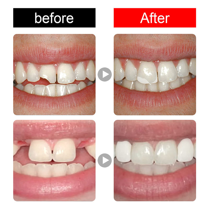[Australia] - 56 Pcs False Teeth Dental Complete Acrylic Resin Denture Teeth, 2 Set Whole Teeth Synthetic Polymer Denture Tooth, 23 Shade A3 Upper + Lower Dental Materials for Replacement, DIY, or Halloween 