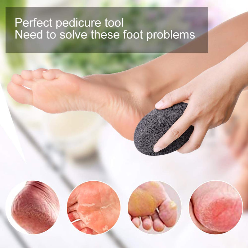 [Australia] - Natural Pumice Stones for Feet, Premium Exfoliator & Foot File,Foot File Callus Remover Foot Cracked Heels,Dead Skin,Hard Skin (Black) Black 