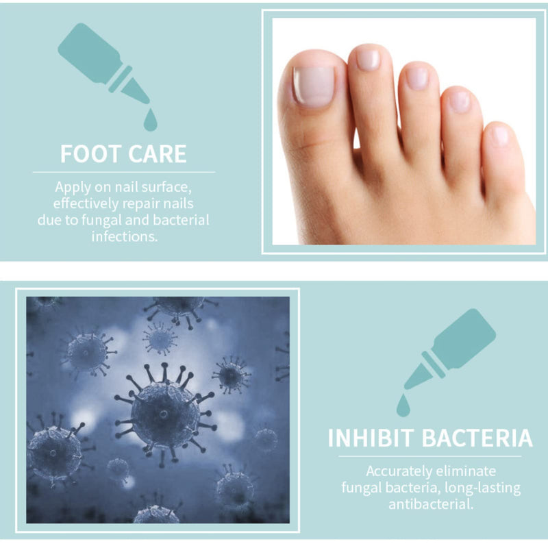 [Australia] - Antifungal Nail Repair,Fungus Treatment Fungal Nail Care,Nail Treatment,Nail Care Solution to Repair Damaged,Cracked and Discolored Nails 