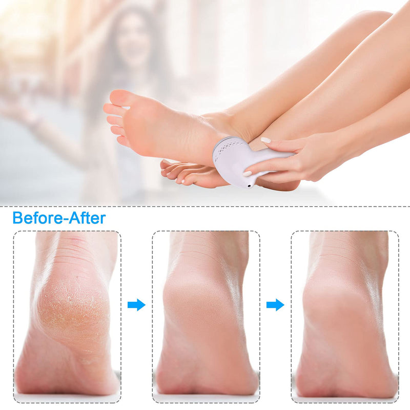 [Australia] - LAYADO Electric Foot Callus Removers, Electric Foot File with 3 Grinding Head & 5 Pedicure Tools Set for Cracked Heels and Dead Skin 