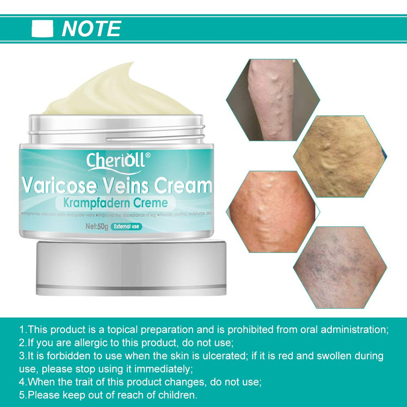 [Australia] - Varicose Veins Cream, Varicose Vein & Soothing Leg Cream, Varicose & Spider Veins, Varicose Vein Discomfort, Pain, Strain(50g) 50g 