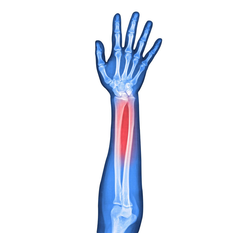 [Australia] - Soles Wrist Splint Brace with Thumb Stabilizer Right Hand (SLS510R) 