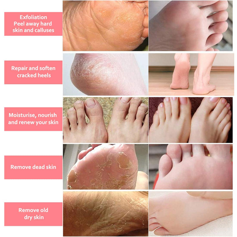 [Australia] - Foot Peel Mask 5 Pack, Peach Soft Callus Peeling Dead Skin Remover Exfoliating Socks Dry Rough Heels Treatment Beauty Feet Mask Natural for Men and Women Pink 