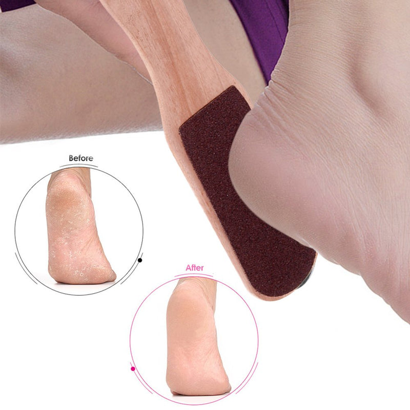 [Australia] - Anself Double Sided Foot Rasp Manicure File Callus Remover Pedicure Tool 1 Count (Pack of 1) 