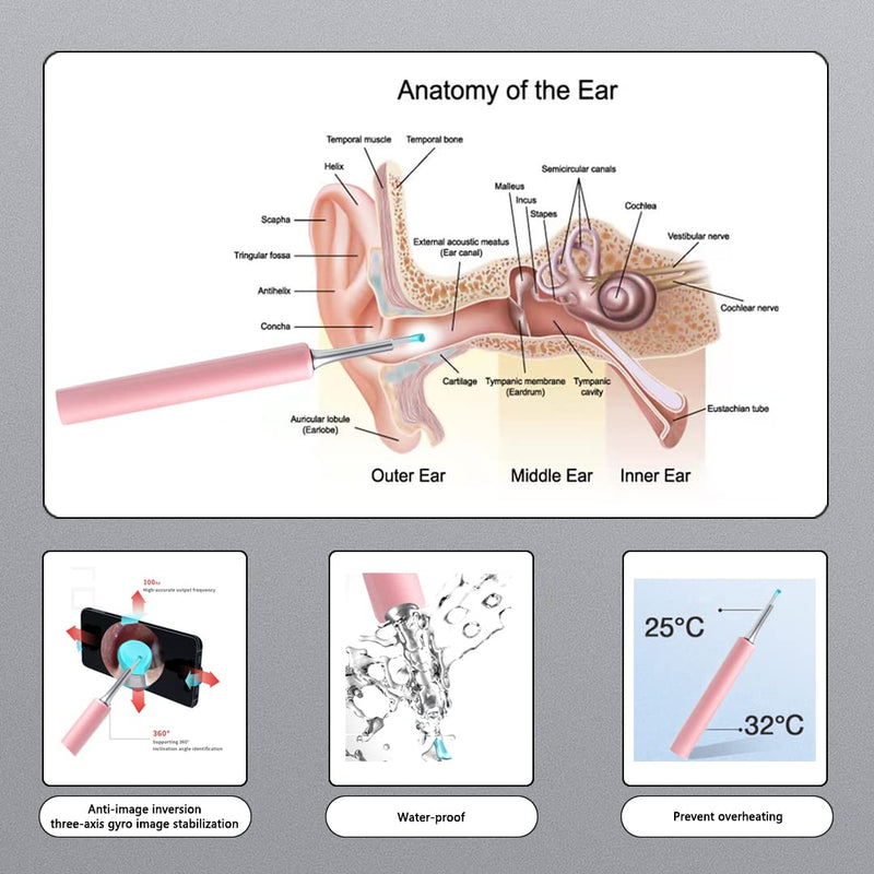 [Australia] - Oxbird(200-300W-PX) HD Wireless Otoscope with Light Ear Wax Camera, Ear Wax Remover Removal Cleaner Cleaning Kit, Suitable for Apple/Android, Dad and Madam Artifact,Perpetual Commitment Pink 