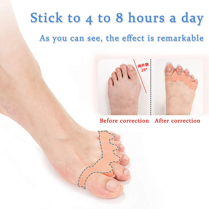 [Australia] - ERSANLI Foot Care Toe Separator / Bonny Separator. Can Relieve Pain, Repair Bunions, Hammer Toes, Overlap Toes, Toe Stretchers, Separate, Protect And Relax Toes (Unisex, Beige, 2 Pcs) 