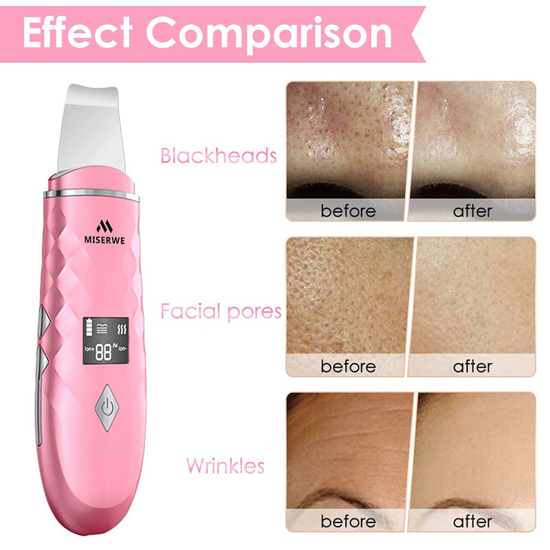 [Australia] - Skin Scrubber with LCD Display Skin Spatula Pore Cleaner Blackhead Remover Face Beauty Lifting Tool Comedones Extractor with 4 Modes, Heat Facial Scrubber Spatula for Deep Cleansing 