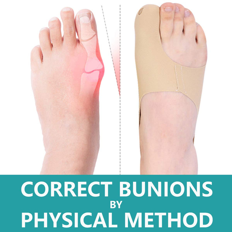 [Australia] - Bunion Corrector, Bunion Relief Orthopedic Bunions Splints Corrector Foot Bunion Brace Toe Separators Treat Pain in Hallux Valgus, Big Toe Straightener, Hammer Toe for Women & Men Small 