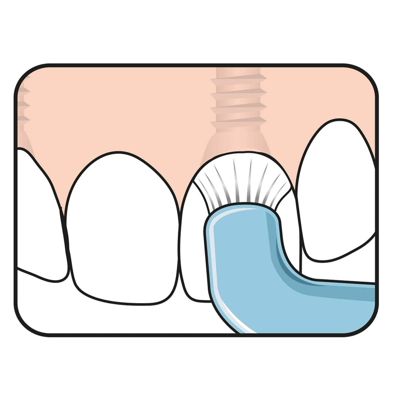 [Australia] - TEPE Compact Single Tuft Brush for Precision Cleaning of Difficult Areas, Such as Braces, Gum line and implants - 1 x TEPE Compact Brush (Pack of 2) 1 count (Pack of 2) 