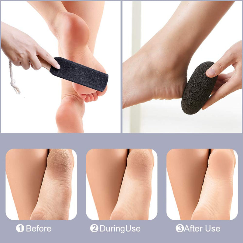 [Australia] - Natural Pumice Stones for Feet, Premium Exfoliator & Foot File,Foot File Callus Remover Foot Cracked Heels,Dead Skin,Hard Skin (Black) Black 