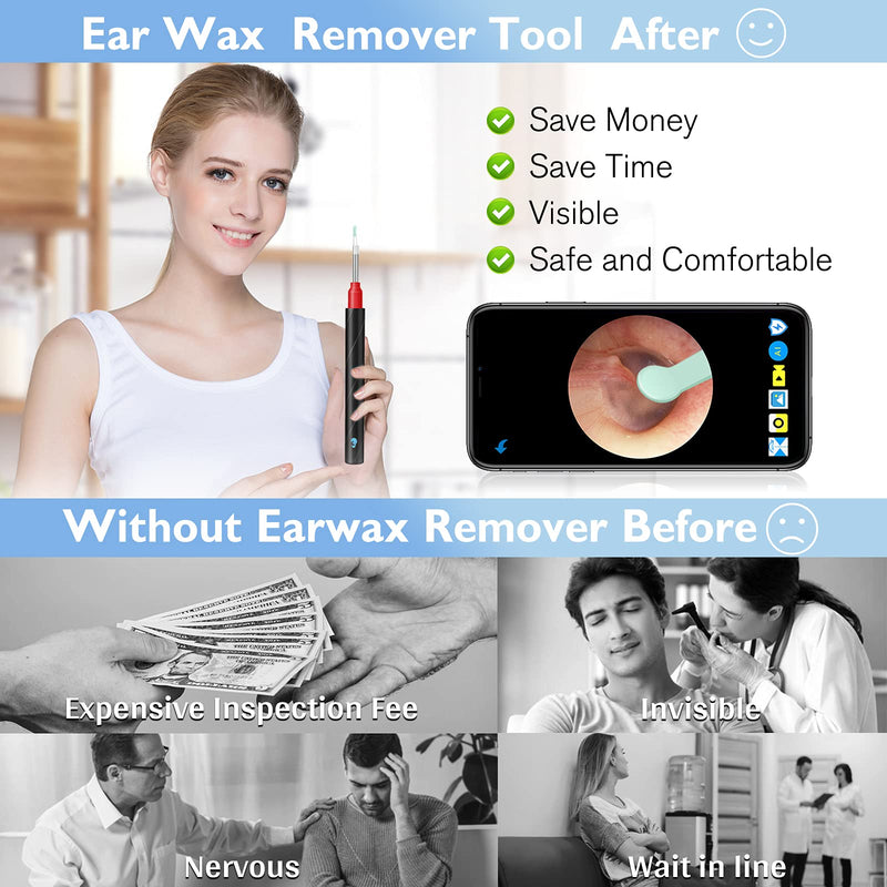 [Australia] - Urbesty Earwax Removal Tool,HD Wireless Otoscope Ear Wax Remover Kits Visual Ear Cleaning Endoscope with Light 3.5mm WiFi Ear Camera with Ear Spoons 