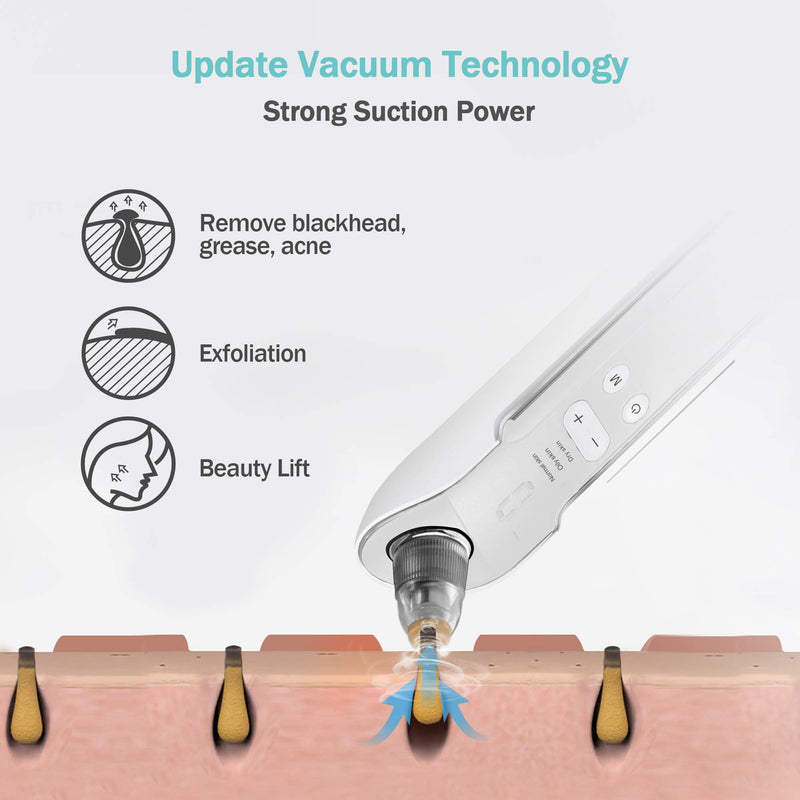 [Australia] - Blackhead Remover Face Pore Vacuum Cleaner EZBASICS Upgraded Blackhead Vacuum Rechargeable White Heads Removal with 3 Adjustable Suction Power Blackhead Extractor Tool with LED Display(White) 