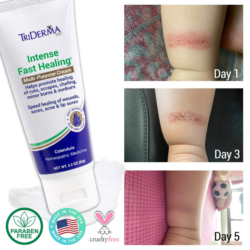 [Australia] - TriDerma Intense Fast Healing Multi-Purpose Cream for Cuts, Scrapes, Sores, Chafing, Minor Burns and Sunburn (2.2 oz Tube) 
