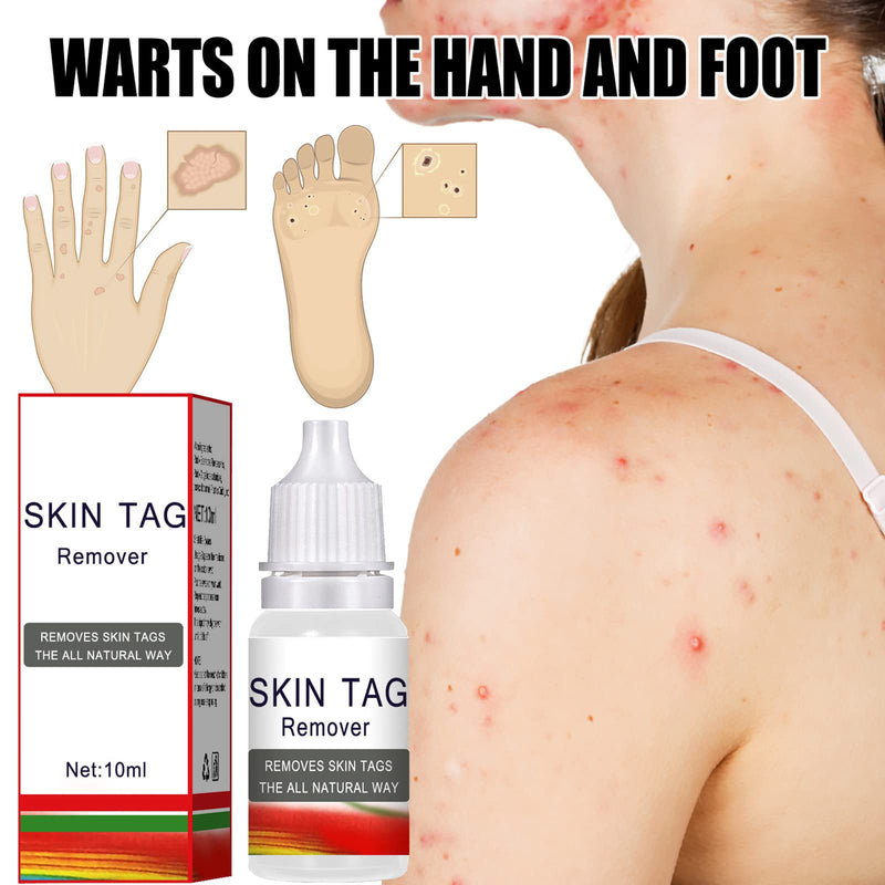 [Australia] - Wart Remover Liquid,Skin Tag Warts Foot Corn Removal,Foot Corn Removal Easy Application Suitable for Hands, Feet, Face and Body(10ml) 