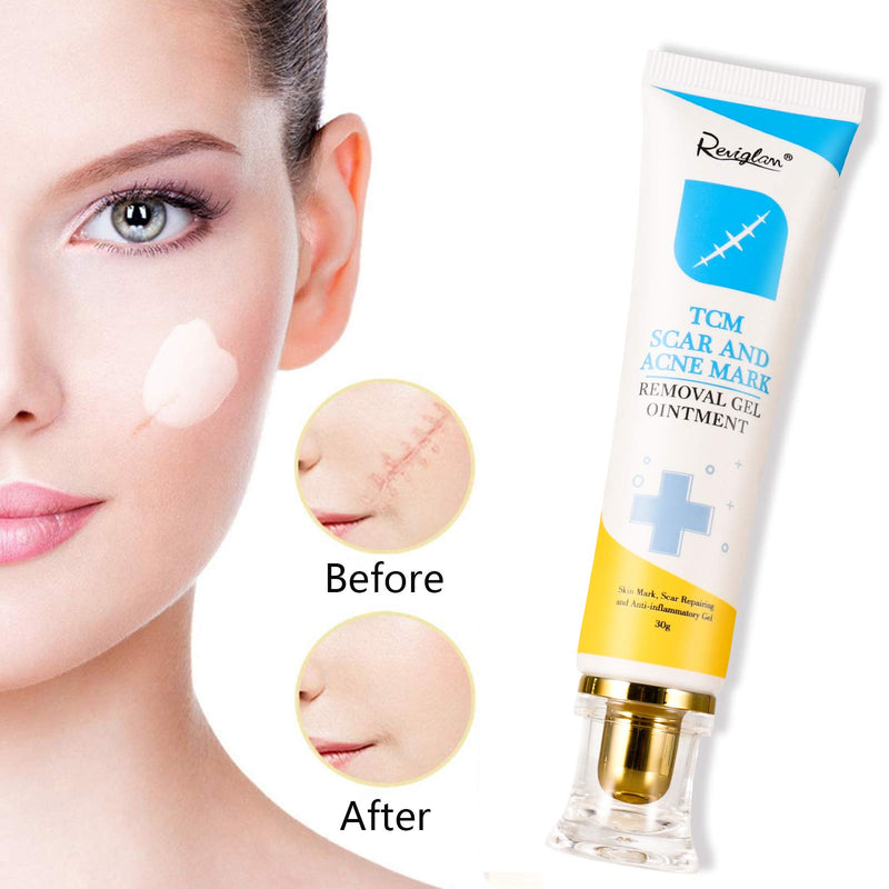 [Australia] - Scar and Acne Marks Removal Ointment Gel, Scar Removal Cream, Scar Gel for Scars Burns Cuts, Stretch Marks, Acne Spots, Old & New Scars, 30g 