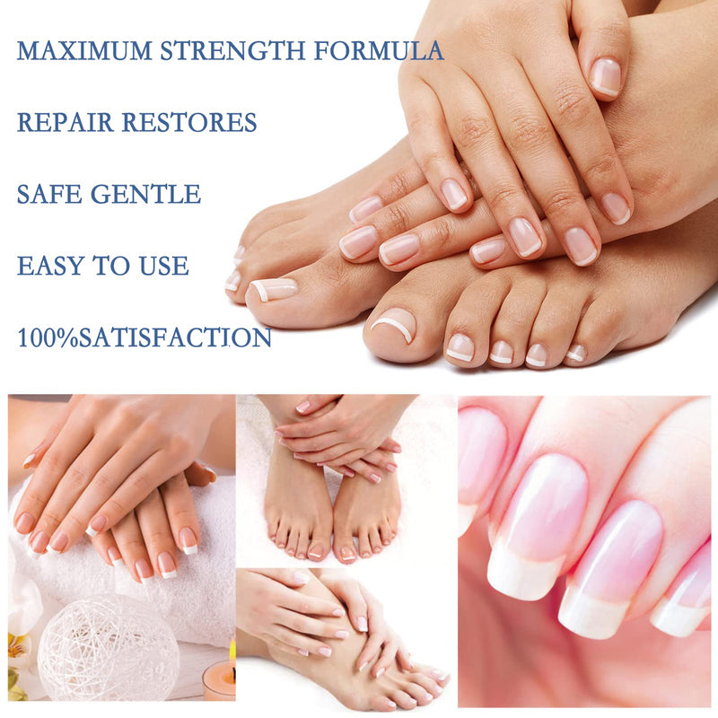 [Australia] - Antifungal Nail Repair,Fungus Treatment Fungal Nail Care,Nail Treatment,Nail Care Solution to Repair Damaged,Cracked and Discolored Nails 