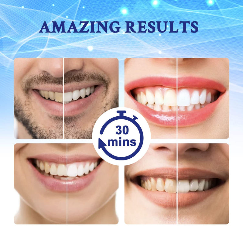 [Australia] - Teeth Whitening Strips(40 strips), Teeth Whitening, Whiter in 14 Days, Zero Peroxide, Safe and Effective Whitening Strips, Professional Teeth Whitening Strips 