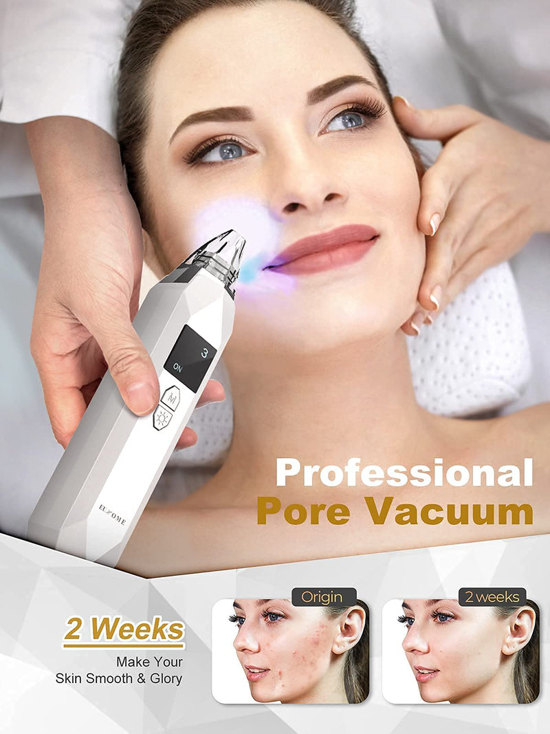 [Australia] - Blackhead Remover Pore Vacuum EUHOME Electric Rechargeable Blackhead Whitehead Acne Comedone Pimple Extractor Facial Pore Cleaner Blackhead Removal Kit 5 Suction Probes Face Cleaning Tools 