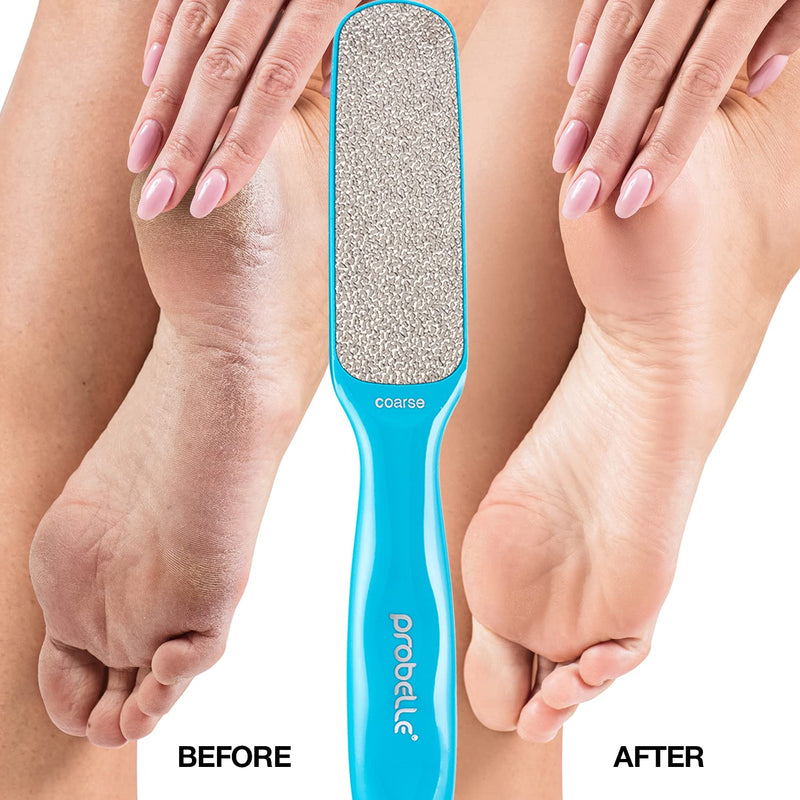 [Australia] - Probelle Double Sided Multidirectional Nickel Foot File Callus Remover - Immediately reduces calluses and corns to powder for instant results, safe tool (Blue) Blue 