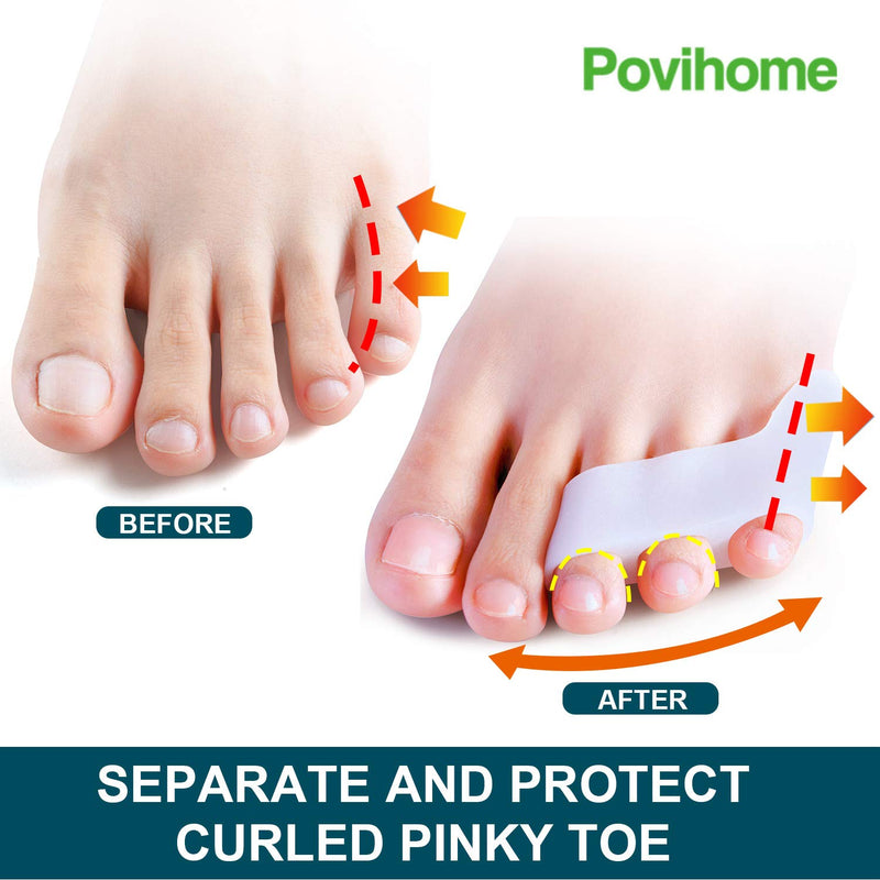 [Australia] - Povihome 10 Pack Pinky Toe Separator and Protectors, Triple Gel Toe Separators for Overlapping Toe, Curled Pinky Toes Separate and Protect 