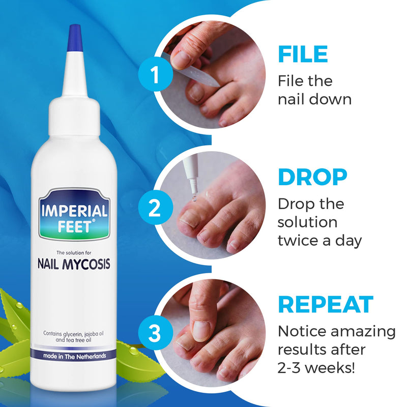 [Australia] - Anti Fungal Nail Treatment | Severe Fungal Nail Treatment for Toenails Extra Strong | Extra Large 75ML 