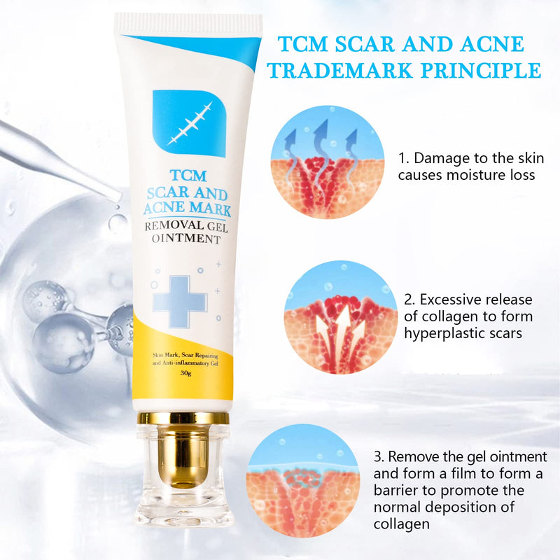 [Australia] - 2pcs Scar and Acne Marks Removal Ointment Gel, Scar Removal Cream, Skin Repair Scars Burns Cuts, Stretch Marks, Acne Spots, Scar Gel 30gx2 