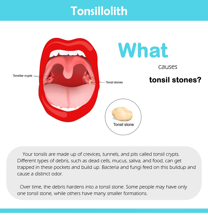 [Australia] - Tonsil Stone Remover Tool and Personal Oral Care Kit 5 in 1 - Tongue Scraper, Syringe, Mouth Mirror, and Tonsil Scoop with LED Light 