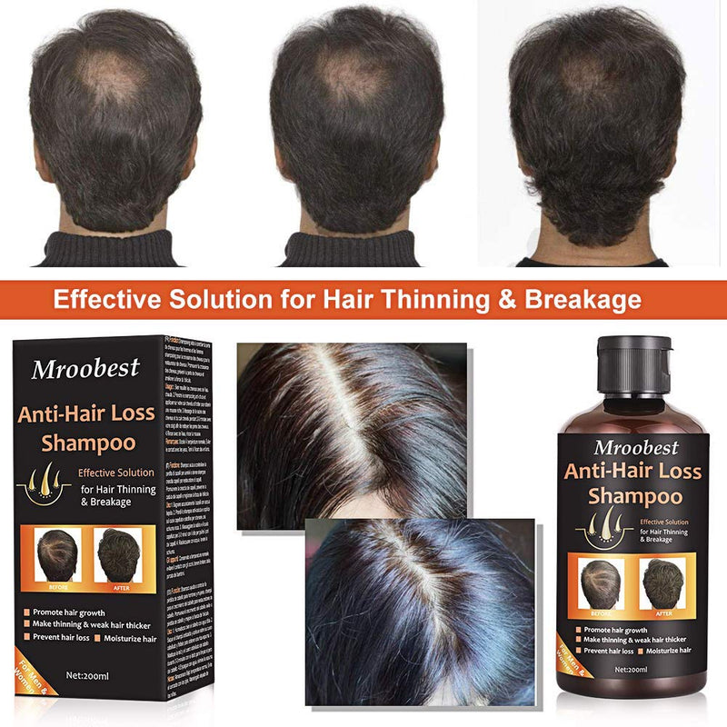 [Australia] - Anti-Hair Loss Shampoo, Hair Growth Shampoo, Effective Solution for Hair Thinning & Breakage, Helps Stop Hair Loss, Grow Hair Fast, Hair Loss Treatment for Men & Women(220mL) 220 ml (Pack of 1) 