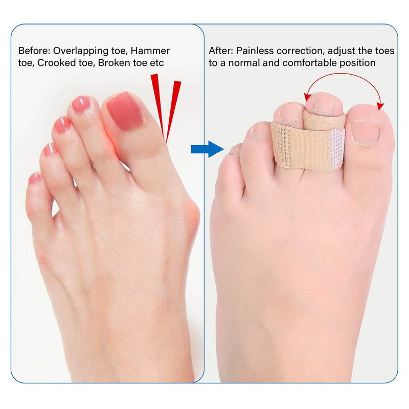 [Australia] - DYKOOK Broken Toe Wraps 8 Pcs/Pack Fabric Toe Splint Toe Cushioned Bandages Finger Protectors Straightener Separators 
