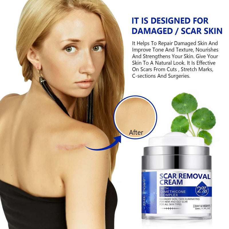 [Australia] - Scar Removal Cream - Rapid Repair of New and Old Scars - Scar Removal and Soothing Cream for Surgical Scars, Acne Scars, C-Section, Burns, Stretch Marks 