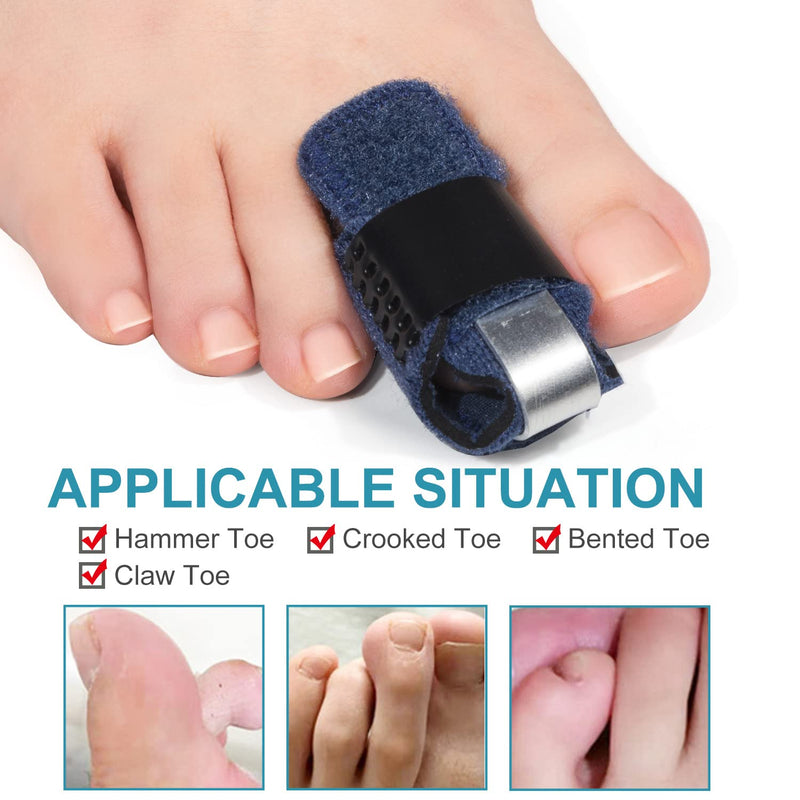 [Australia] - Welnove 1 Pair Toe Splint,Toe Straightener for Hammer Toe,Bent Toe,Claw Toe,Crooked Toe,Toe Wrap to Align and Support Toe -- Blue Blue-Toe 