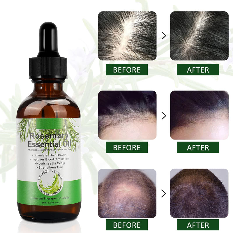 [Australia] - Rosemary Oil for Hair Growth & Skin Care, Hair Loss and Hair Regrowth Treatment, Stimulates Hair Growth, Improves Blood Circulation for Men and Women 2.02 Oz (60 mL) 