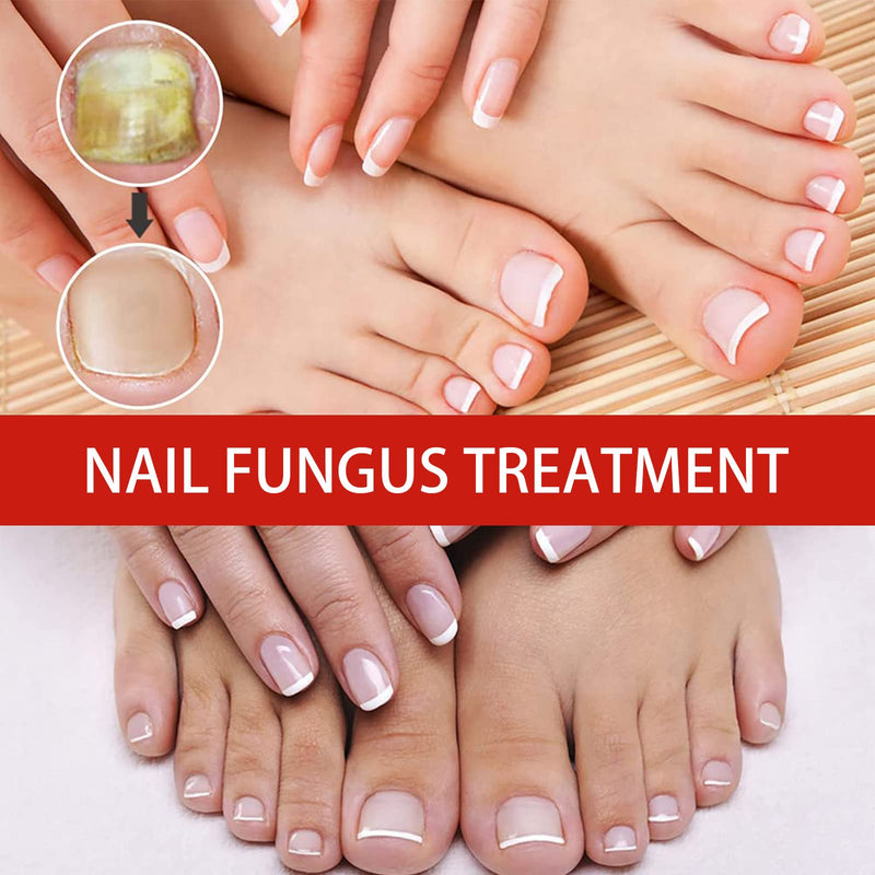 [Australia] - Nail Care Solution,Anti fungal Nail Solution,Nail Fungus Solution,Fungal nail,Nail Fungus Fungus Stop,Restores Appearance of Discolored 