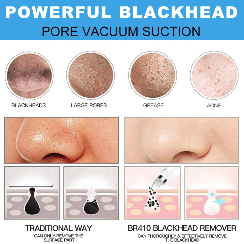 [Australia] - 2021 UPGRADED Blackhead Remover Vacuum, Electric Skin Pore Cleaner Blackhead Vacuum Suction Removal Rechargeable Skin Peeling Machine Comedone Acne Comedo Suction Beauty Device For Nose Face Women Men White 